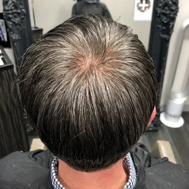 Client 01 after their hair system