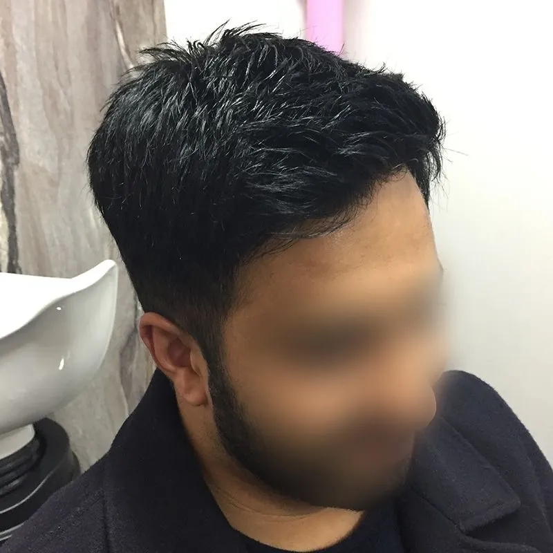 Client 04 after their hair system