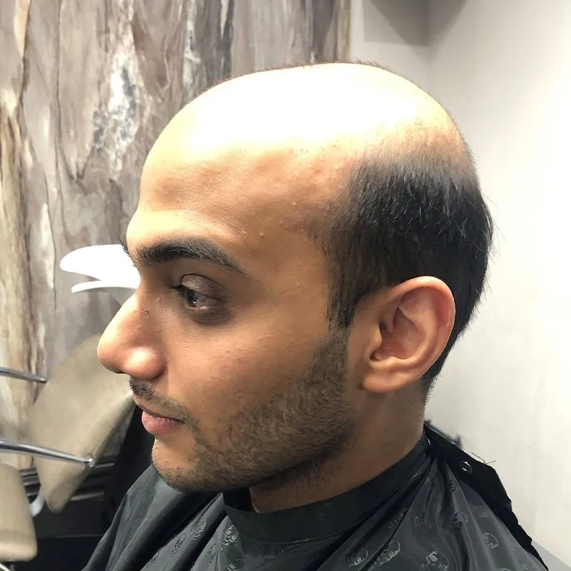 Client 07 before their hair system