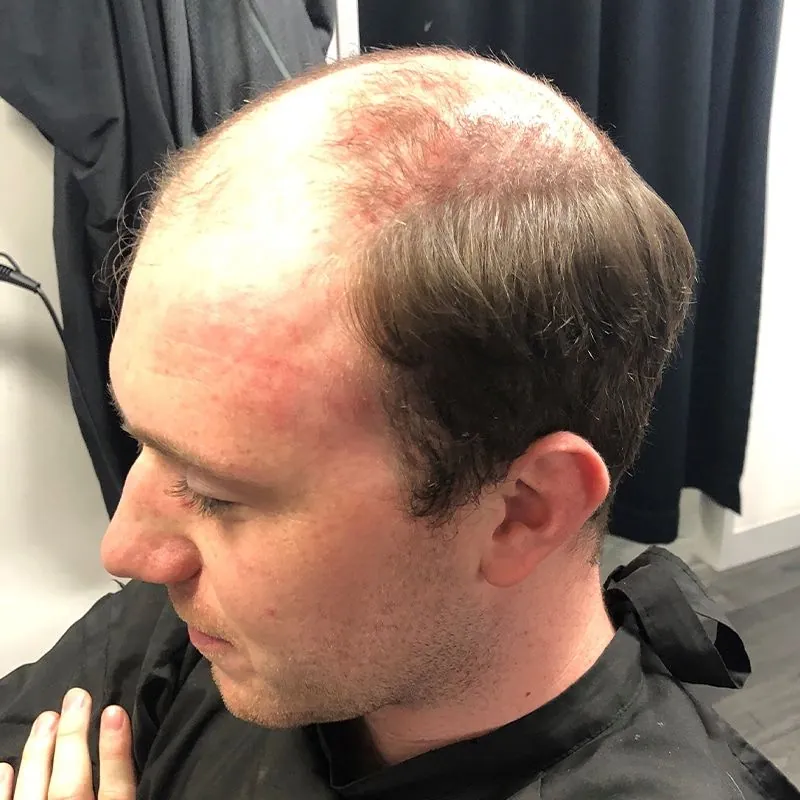 Client 10 before their hair system