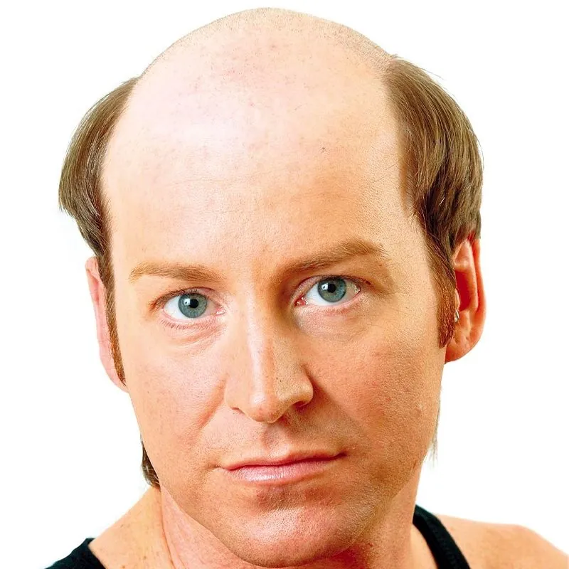 Client 09 before their hair system