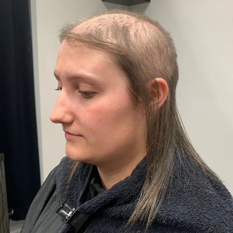 Client 02 before their hair system