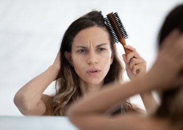 Womens receding hairline